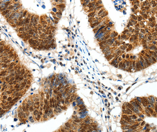 SP1 Polyclonal Antibody (E-AB-16069)