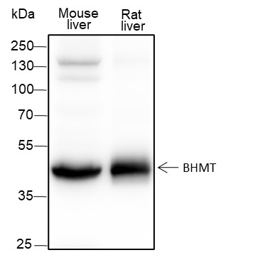 Recombinant BHMT Monoclonal Antibody (AN301446L)