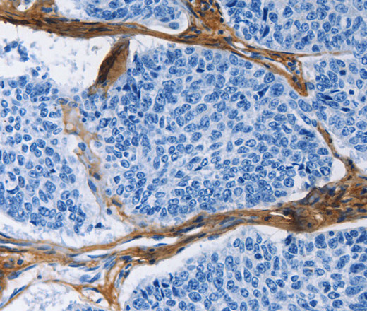 COL3A1 Polyclonal Antibody (E-AB-10250)