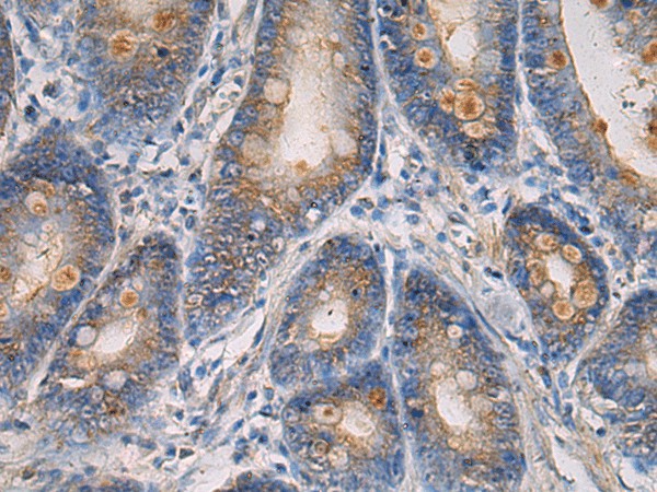 MAPKAPK3 Polyclonal Antibody (E-AB-53182)