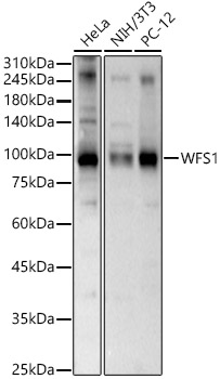 WFS1 Polyclonal Antibody (E-AB-91688)
