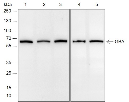 Recombinant GBA Monoclonal Antibody (AN301962L)