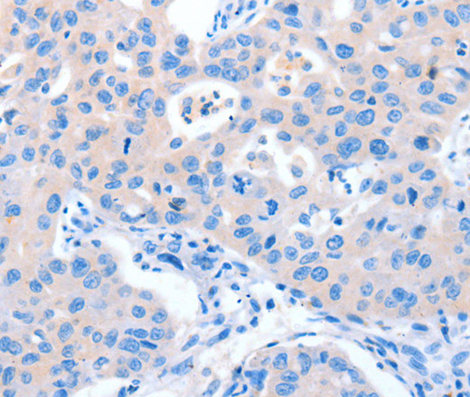NUAK1 Polyclonal Antibody (E-AB-12986)