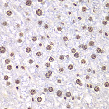 TOP1 Polyclonal Antibody (E-AB-64227)