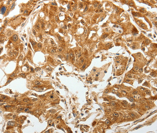 TGF β Receptor I Polyclonal Antibody (E-AB-12904)