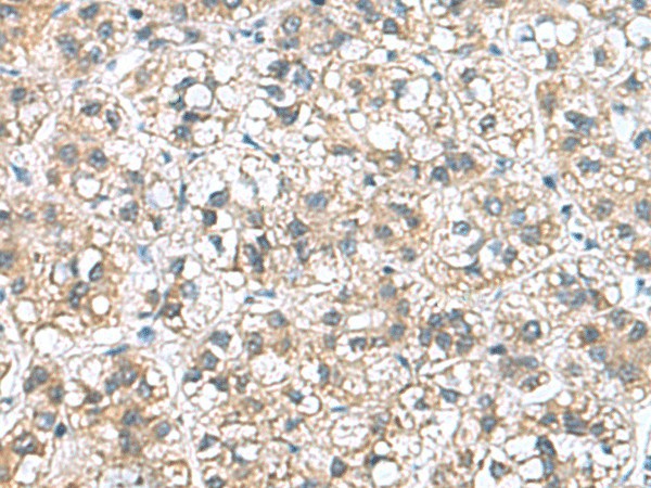 NFKB1 Polyclonal Antibody (E-AB-52132)