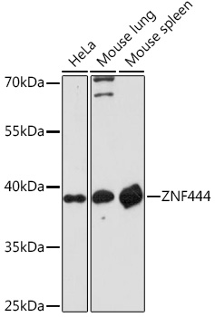 ZNF444 Polyclonal Antibody (E-AB-92061)