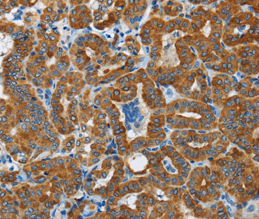 FLCN Polyclonal Antibody (E-AB-15043)