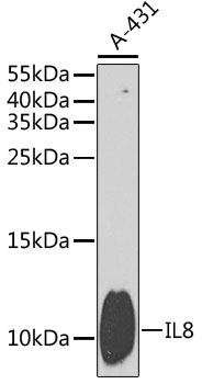 IL8 Polyclonal Antibody (E-AB-60717)