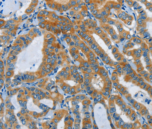 DDAH1 Polyclonal Antibody (E-AB-16196)