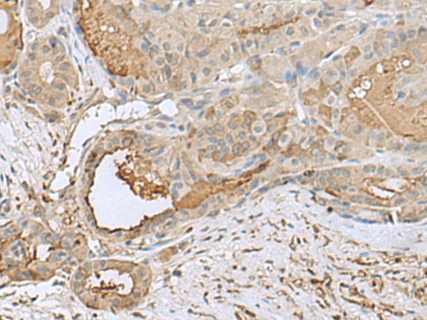 GABARAPL2 Polyclonal Antibody (E-AB-19104)