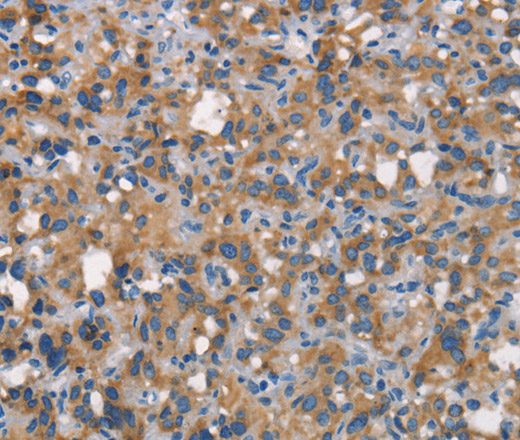 CEACAM6 Polyclonal Antibody (E-AB-15980)