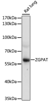 ZGPAT Polyclonal Antibody (E-AB-66864)