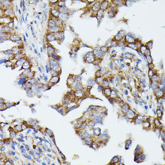 MTIF2 Polyclonal Antibody (E-AB-66801)