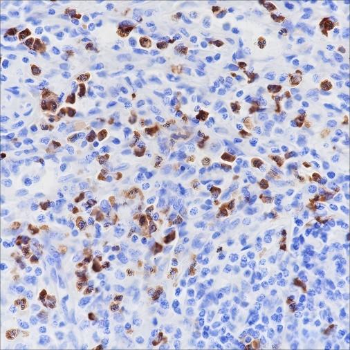 Recombinant CD15/SSEA1 Monoclonal Antibody (AN301464L)