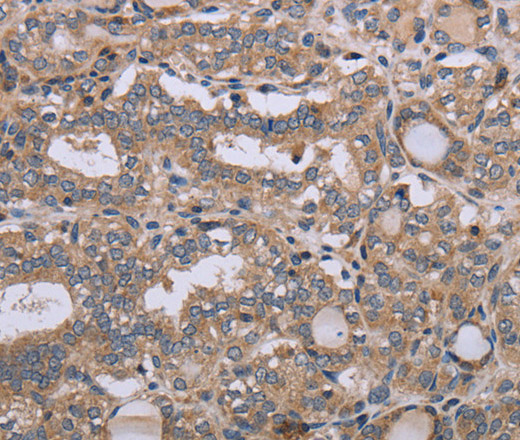 NAA25 Polyclonal Antibody (E-AB-16630)