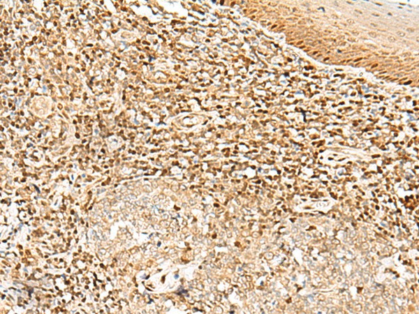 DNPEP Polyclonal Antibody (E-AB-52753)