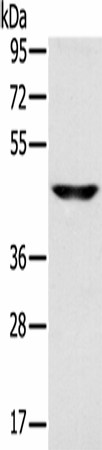 SLC16A8 Polyclonal Antibody (E-AB-16823)