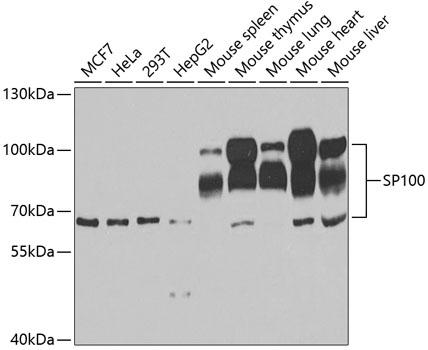 SP100 Polyclonal Antibody (E-AB-61150)