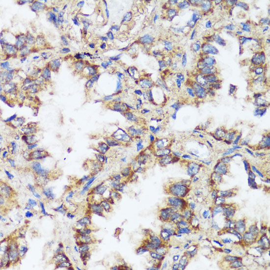 ERK1 / ERK2 Polyclonal Antibody (E-AB-66902)