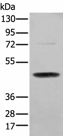 SERPINH1 Polyclonal Antibody (E-AB-53454)