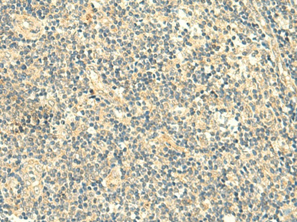 TMEM9 Polyclonal Antibody (E-AB-18923)