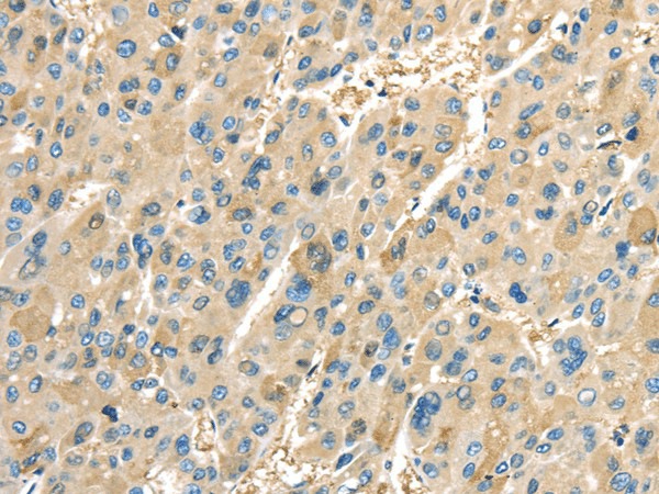 COX2 Polyclonal Antibody (E-AB-17010)