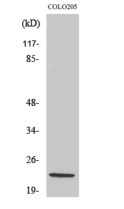 NDUFB10 Polyclonal Antibody (E-AB-32179)