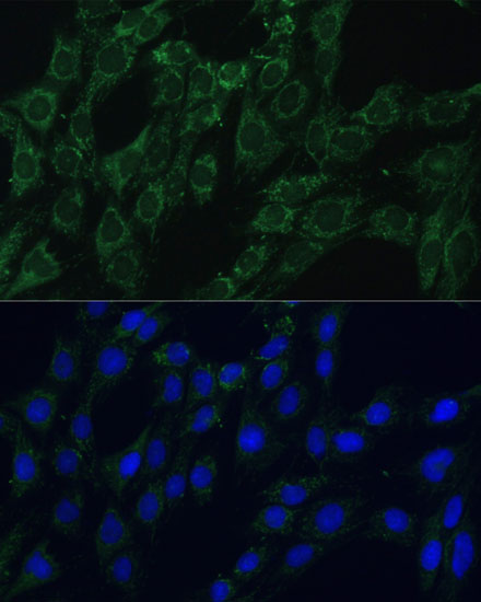 AEBP1 Polyclonal Antibody (E-AB-66768)