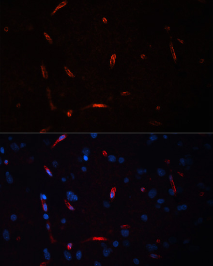 HCRTR1 Polyclonal Antibody (E-AB-66336)