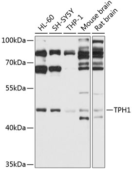 TPH1 Polyclonal Antibody (E-AB-91247)