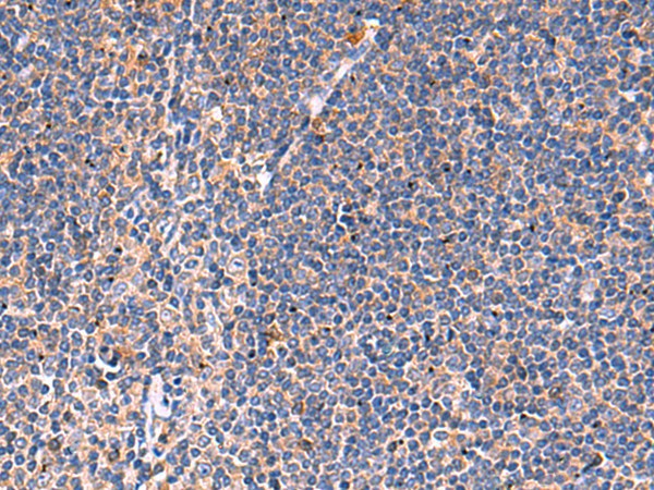 KLK9 Polyclonal Antibody (E-AB-52063)