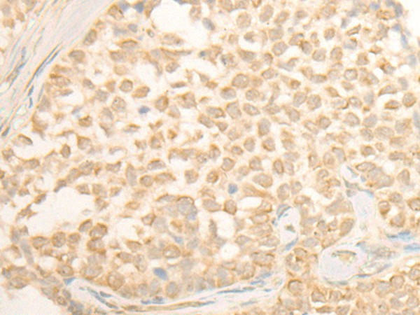 CYP4X1 Polyclonal Antibody (E-AB-52565)