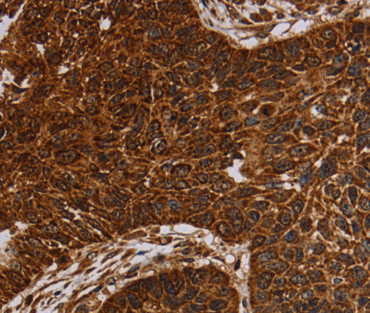 NDUFAB1 Polyclonal Antibody (E-AB-13443)