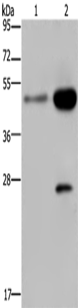 CD160 Polyclonal Antibody (E-AB-14838)