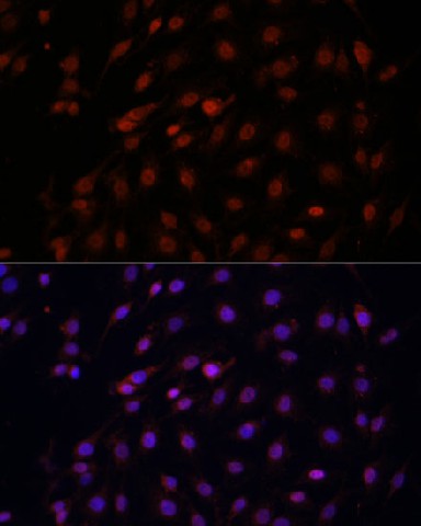 Bcl-2 Polyclonal Antibody (E-AB-60012)