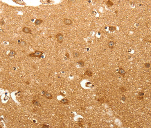 MAP1B Polyclonal Antibody (E-AB-12896)