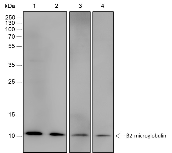 Recombinant beta-2-Microglobulin Monoclonal Antibody (AN301849L)