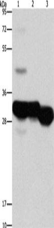 KHK Polyclonal Antibody (E-AB-10947)
