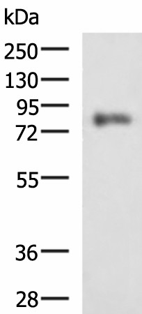 PRKCSH Polyclonal Antibody (E-AB-53187)