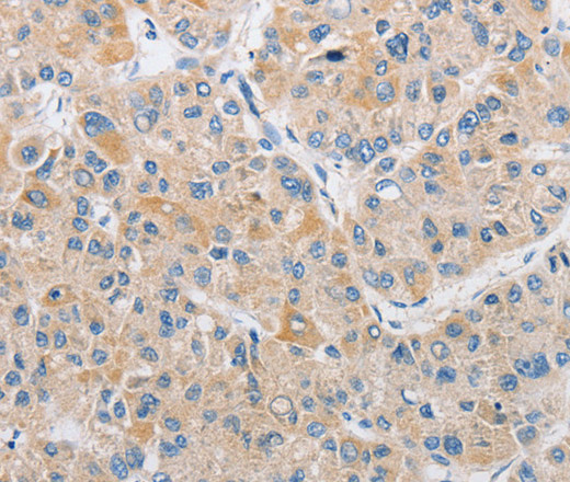 ARHGEF9 Polyclonal Antibody (E-AB-10834)