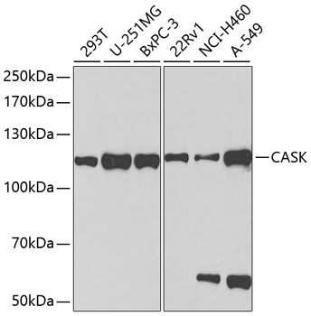 CASK Polyclonal Antibody (E-AB-60698)