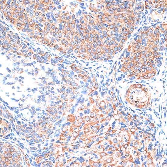 TIMP2 Polyclonal Antibody (E-AB-66821)