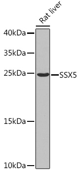 SSX5 Polyclonal Antibody (E-AB-62927)