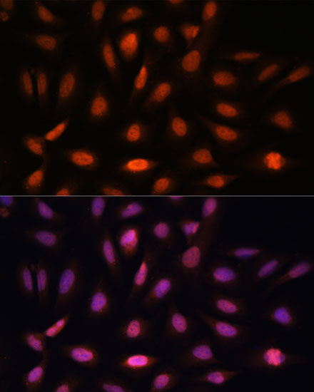 PPIL4 Polyclonal Antibody (E-AB-66624)