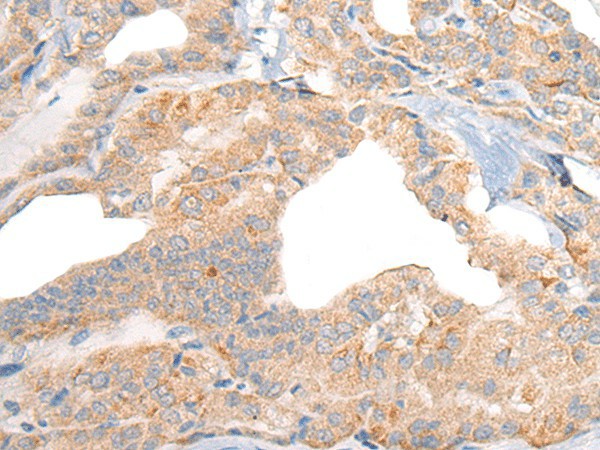 RGS19 Polyclonal Antibody (E-AB-17860)