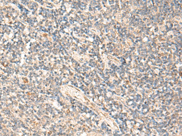 MOB1A Polyclonal Antibody (E-AB-52854)