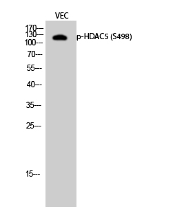 Phospho-HDAC5 (Ser498) Polyclonal Antibody (E-AB-20888)