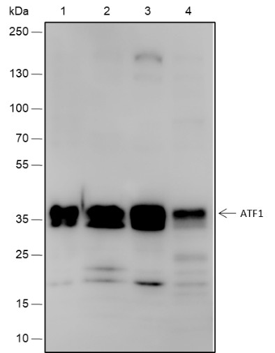 Recombinant ATF1 Monoclonal Antibody (AN301850L)