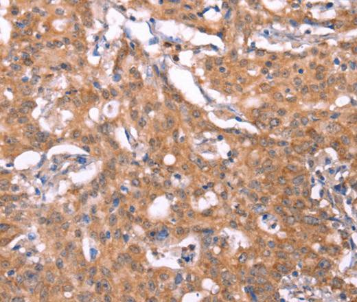 FBXO31 Polyclonal Antibody (E-AB-16428)